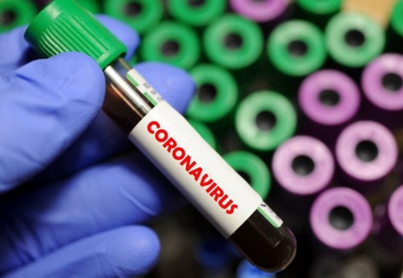 coronavirus.jpg